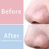 Mig4u Pcs Exfoliating Facial Scrubber Mitt Face Cleanser Wash Mittens