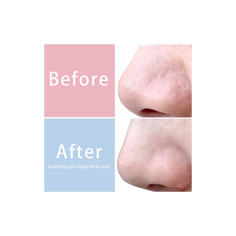 Mig4u Pcs Exfoliating Facial Scrubber Mitt Face Cleanser Wash Mittens