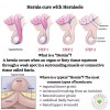 Forest Organics Salud hernia hiatal,ayuda con hernia umbilical, hernia discal,
