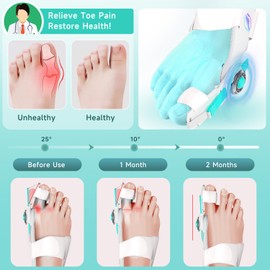 HUQKIYA Bunion Corrector for Women & Men, Orthopedic Bunion Splint with Toe Separator Adjustable Toe Straightener Suitable for Left/Right Feet Hallux Valgus Relief(White 2Pcs)