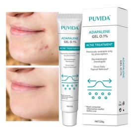 Crema Antipolvo De Dilución De Marcas De Acné 20g