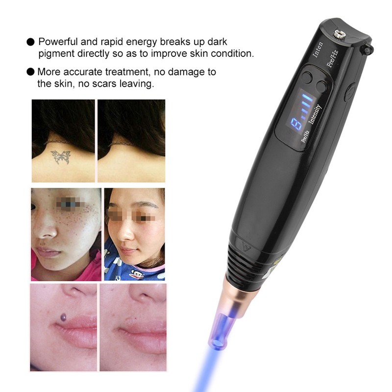 Blue Light Picosecond Pen Scar Tattoo Removal Pen For Melanin