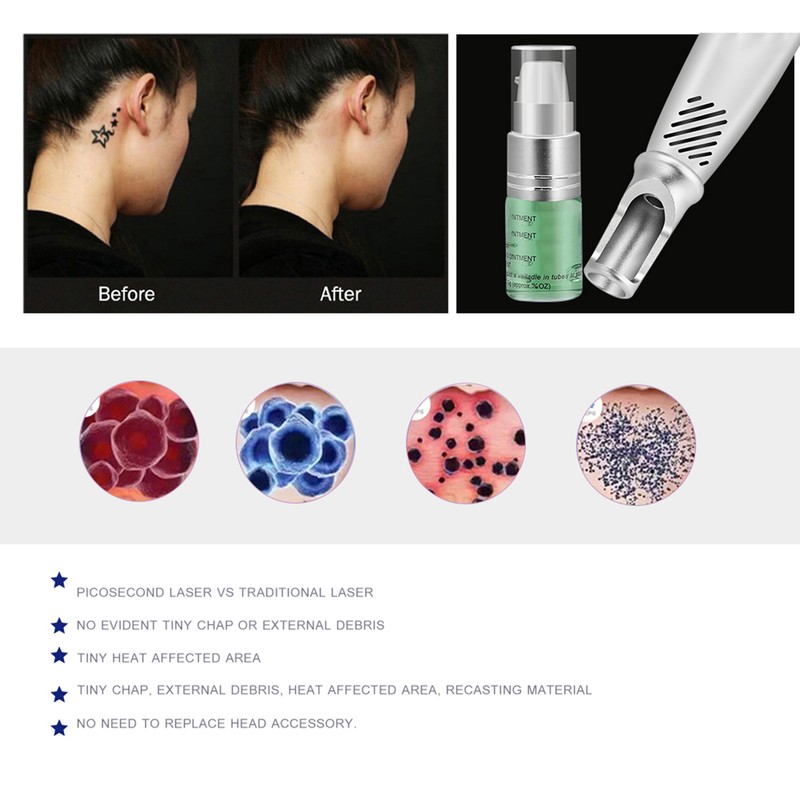 Mole Freckle Removal Machine Tattoo Scar Remover Picosecond Laser Pen