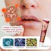 KOAHDE Lip Herpes Repair Cream, Herpes Cream for Lip Sores,