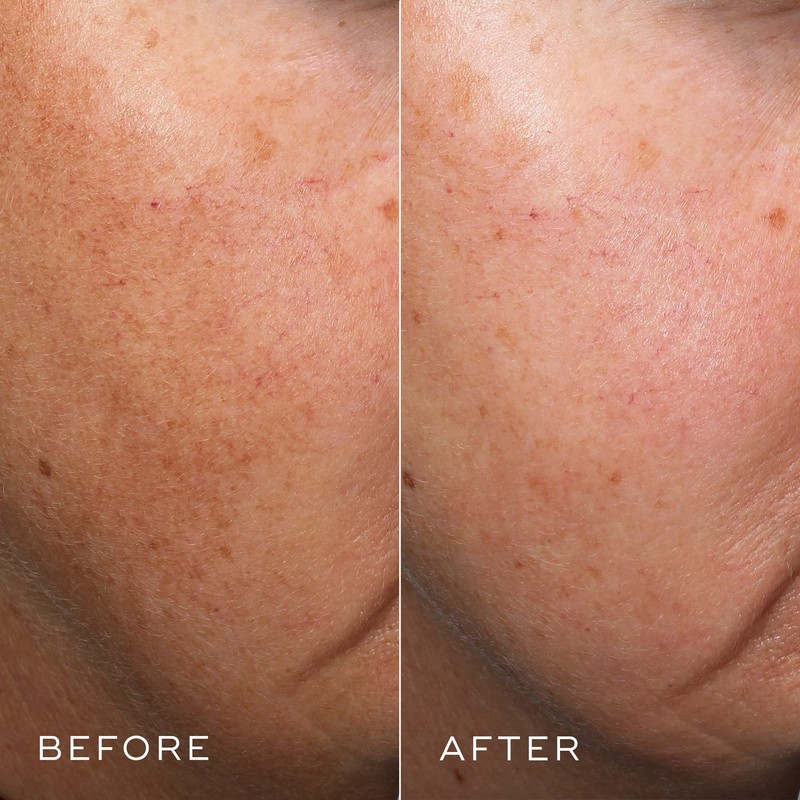 Medik8 Crystal Retinal 6 - Anti-Ageing Retinol Cream for Radiant