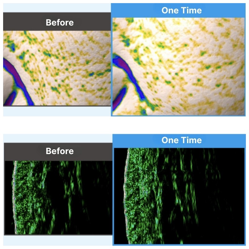 MEDIPEEL Mooltox PDRN Hyal Drop Gel Cream 50ml