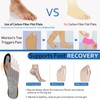 Morton´s Extension Orthotic,Recovery Carbon Fiber Insole, 1Piece, Very Rigid Foot