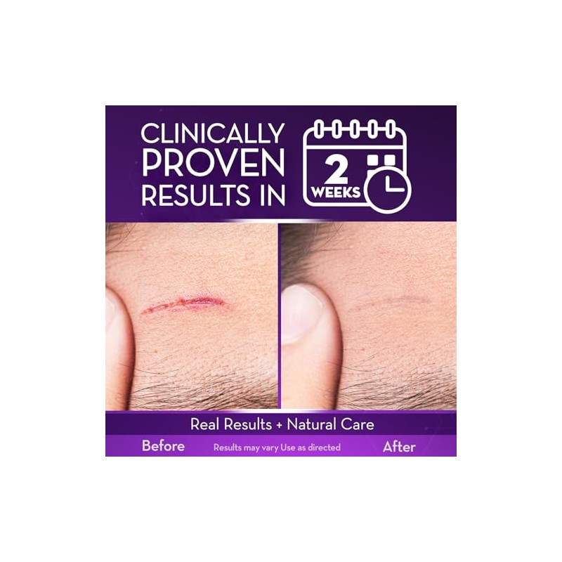 Cicatricure Scar Gel 1.0 oz