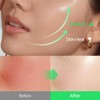 shaishaishai [shaishaishai]Aloe PDRN Cooling Repair Ampoule 50ml