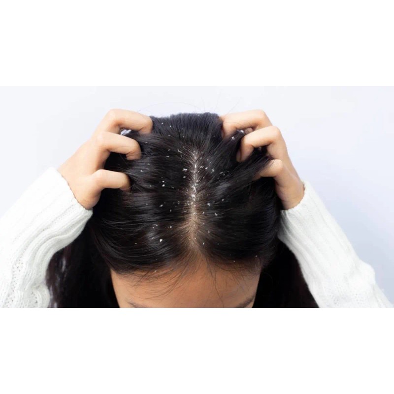 Shampoo Concentrado Ajo Seborrea Resequedad Cabello Graso