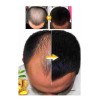 Racotex Locion Para Crecimiento De Pelo Y Barba 100% Efectivo