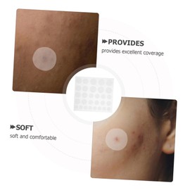 WOONEKY 8 Sheets Transparent Hydrocolloid Pimple Patches for Treatment Stickers Discreet and