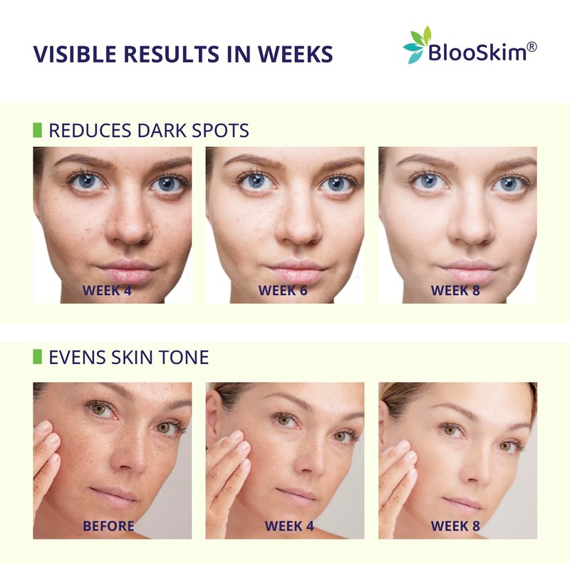 Turmeric Kojic Acid Cleansing Pads – Exfoliating & Brightening Face