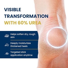 60% Urea Cream Foot Care Stick with 2% Salicylic Acid – Intensive Heel Balm & Foot Moisturizer for Dry Rough Cracked Feet and Thickened Skin – Mess-Fr