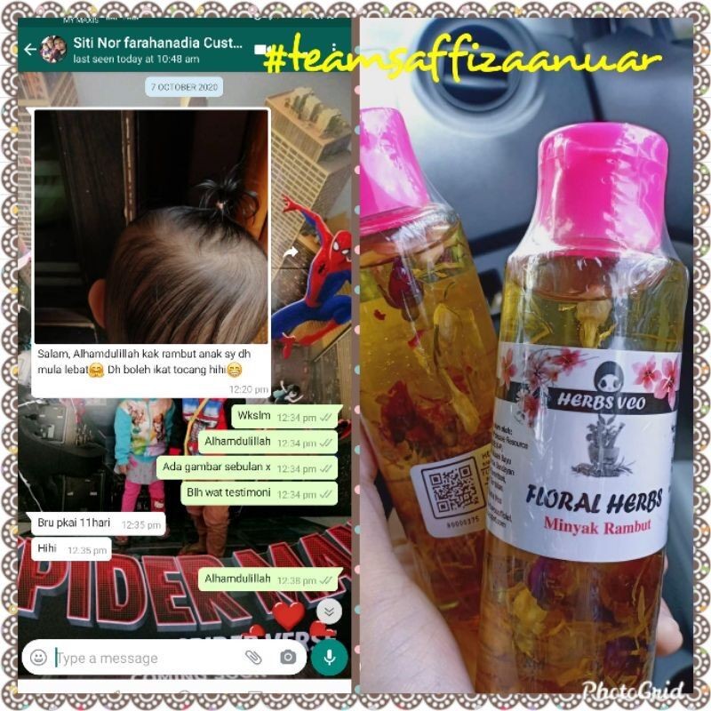 vco 🔥BEST SELLING🔥🎁+ MINYAK RAMBUT FLORAL HERBS [TANPA BAHAN KIMIA]