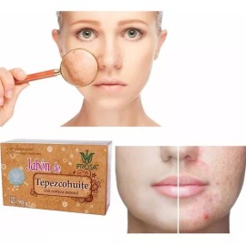 Prosa Jabon Prosa Tepezcohuite Orgánico Sin Colores Artificiales
