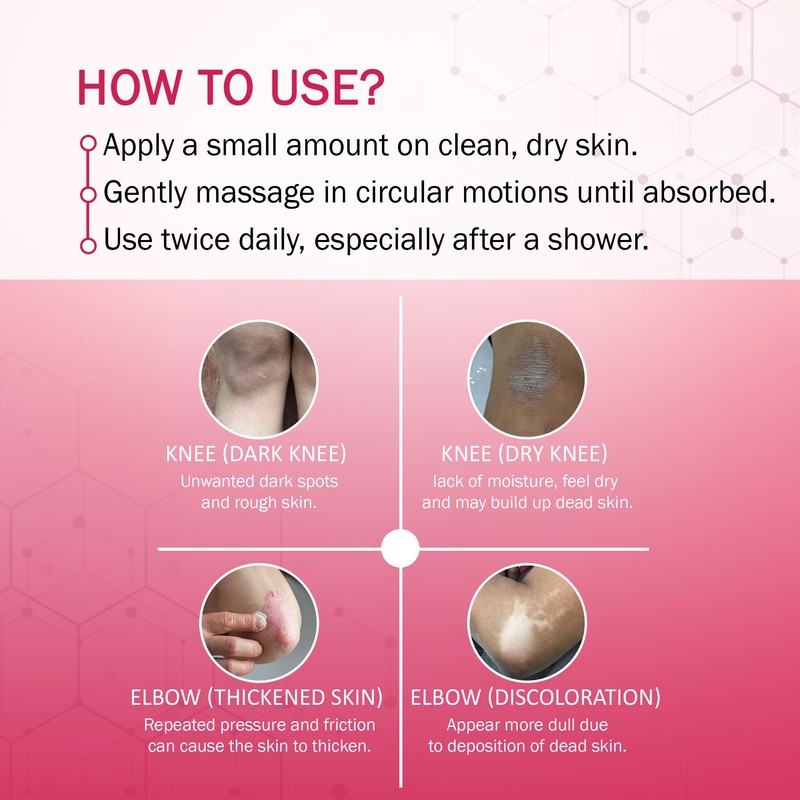 7 DAYS Elbow & Knee Whitening Cream for Men &