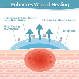 Hydrocolloid Bandages for Wound Care Dressing, 6.6ft Hydrocolloid Roll DIY Size & Shape Hydrocolloid Patch with Self-Adhesive for Burn, Blister, Acne Care (2in x 6.6ft)