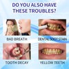Hotluck Whitening Toothpaste: Brightens Smiles, Fights Bad Breath, Protects Against