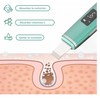 Limpiador Facial Skin Scrubber Peeling Ultrasónico Portátil Verde