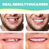 1 Pair Smile Teeth Veneers, Prostheses Fake Teeth, Comfort Instant