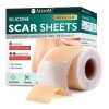 Airroye 1 Roll Silicone Adhesive Scar Sheets 1.6" x 120