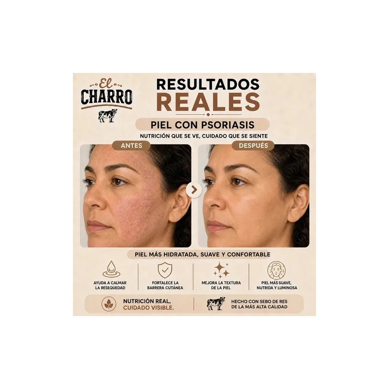 Crema El Charro de Sebo Bovino para Rostro y Cuerpo,