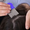 Pack of 2 Lice Comb, Metal Teeth Lice Comb, Double-Sided
