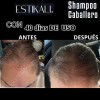 Shampoo Anticaída Anticaspa Antigraso Crecimiento De Cabello