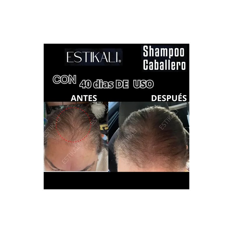 Shampoo Anticaída Anticaspa Antigraso Crecimiento De Cabello
