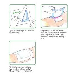 Mesorb Dressing 15cm x 20cm (x10)