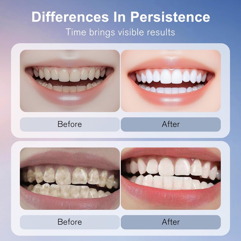 Niacinamide Whitening Toothpaste for Fresh Breath, Gentle Stain Removal &