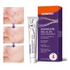 Gel Facial Anti-piel Acne Contiene Adapalene Para Piel Acne