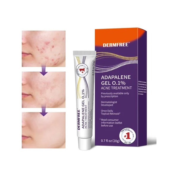 Gel Facial Anti-piel Acne Contiene Adapalene Para Piel Acne