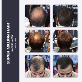 Super Million Hair - No.3 Light Brown - 15g Hair Fibres