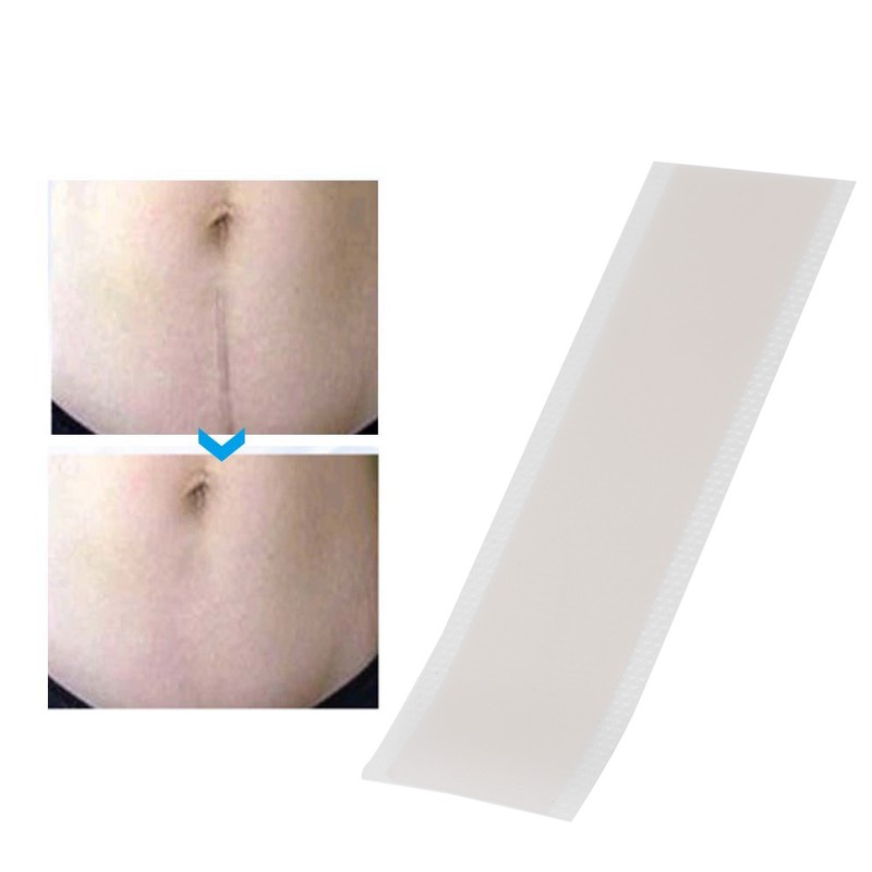 0.4mm Ultra Thin Scar Patch Silicone Gel Wound Marks Removal