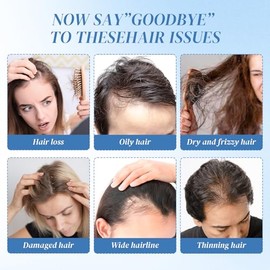 Peine láser para el crecimiento del cabello, tratamiento láser para el crecimiento del cabello, dispositivo de luz roja para uso doméstico para hombre