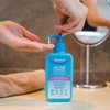 Dermal Therapy Acne Control Wash | Acne Treatment Foaming Cleanser