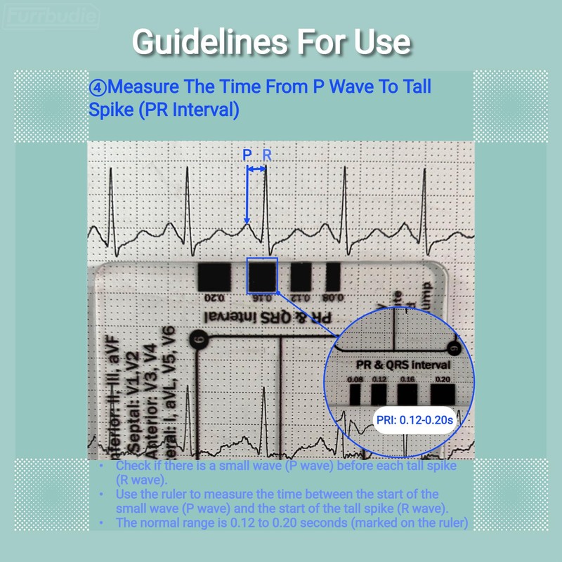 ECG 7 Step Ruler 2pcs ECG Ruler Plastic Ruler Measuring