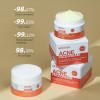 Crema Para El Tratamiento Del Acné Crema Facial Antiacné Pim