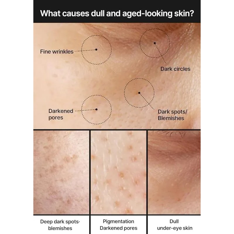 2pc Crema Celimax Pore+dark Spot 35ml Pieltodo Todo Dia