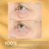 StriVectin, Hyperlift Eye™ Instant Eye Fix