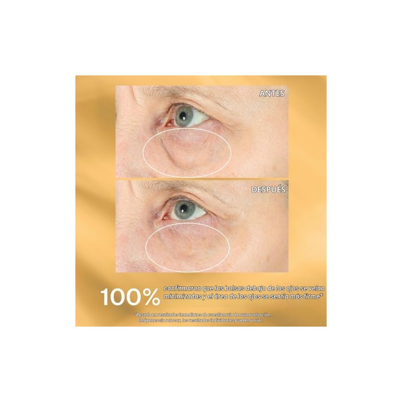 StriVectin, Hyperlift Eye™ Instant Eye Fix