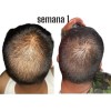2pzs Shampoo Reviving Farmasipara Crecimiento De Cabello