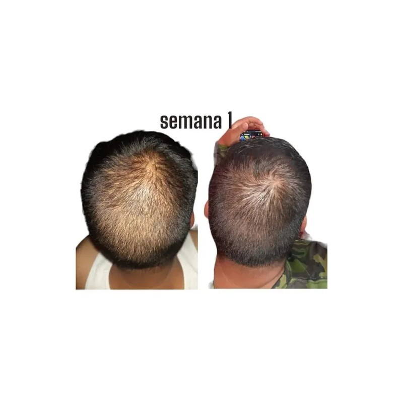 2pzs Shampoo Reviving Farmasipara Crecimiento De Cabello