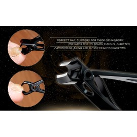 Nail Clippers for Thick Nails - Over 15mm Wide Jaw Opening,Heavy Duty Toenail Clippers for Thick Nails,Fingernail Clippers with Nail File Better for Elderly,Men,nail cutter(Black)