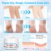 Yunmeng Urea Cream 40 Percent for Feet Maximum Strength, Foot