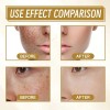 Crema Despigmentante Anti Manchas Zoo·son 20g