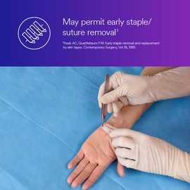 Steri-Strip 3M? Steri-Strip? Reinforced Adhesive Skin Closures, R1548, 1 in x 5 in (25 mm x 125 mm), 4 Strips/Envelope