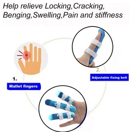 Mcvcoyh Finger Splints, 3-Size Pack Trigger Finger Brace Support, Mallet Finger Splints for Finger Broken, Sprains, Jammed, Fractured Fingers